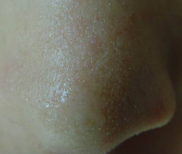 黑头鼻贴的正确贴法图,rnw黑头贴正确用法