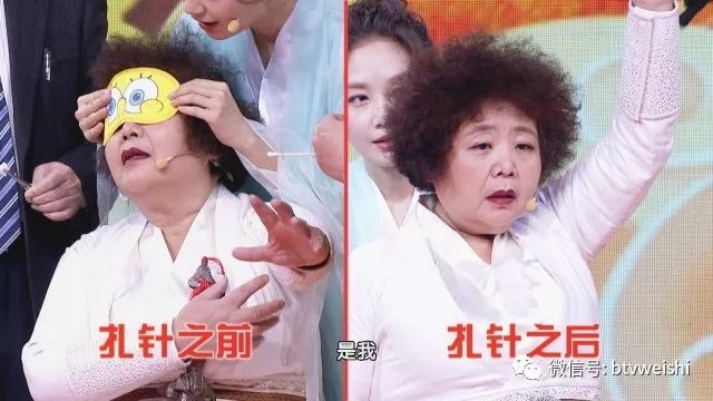 平衡针灸养生堂,养生堂针灸绝技