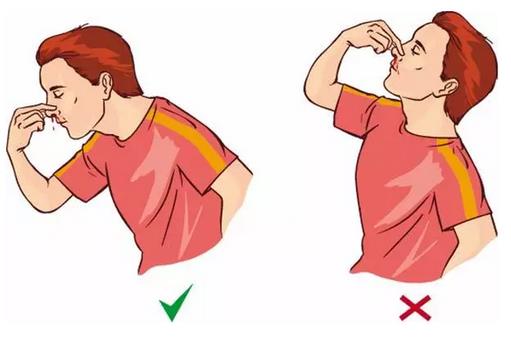 鼻子爱出血有什么偏方,鼻子流血怎么止血冷知识