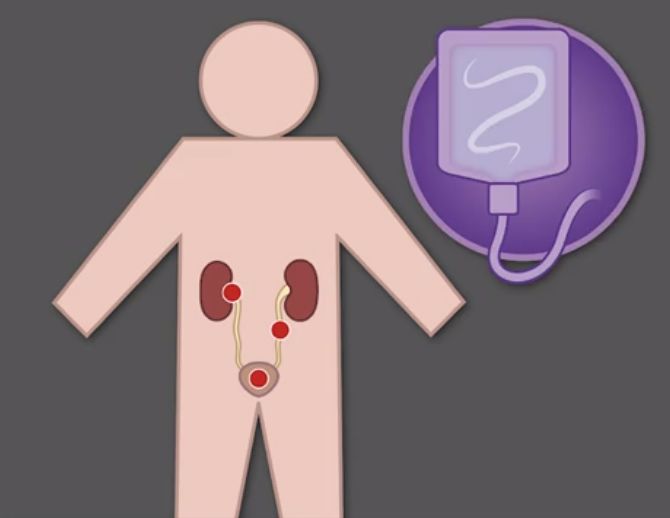 细胞免疫疗法治疗对什么癌症有效,施一公的免疫疗法治癌症最新进展