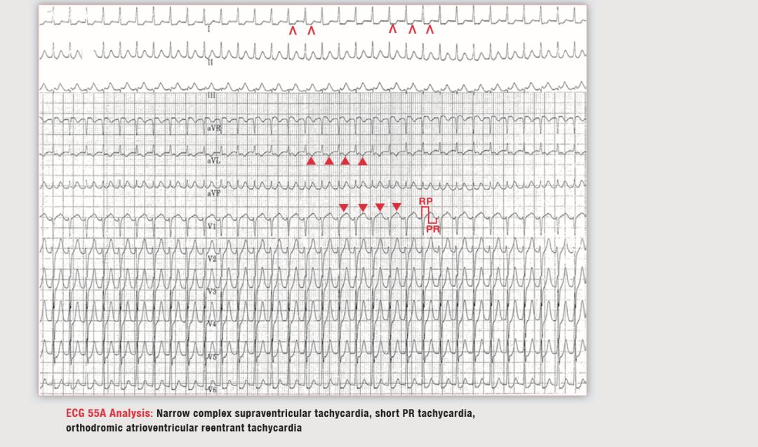 读心有术265,读心有术205期视频