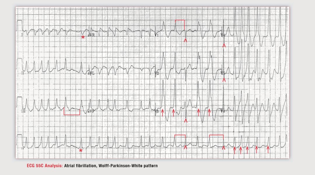 读心有术265,读心有术205期视频