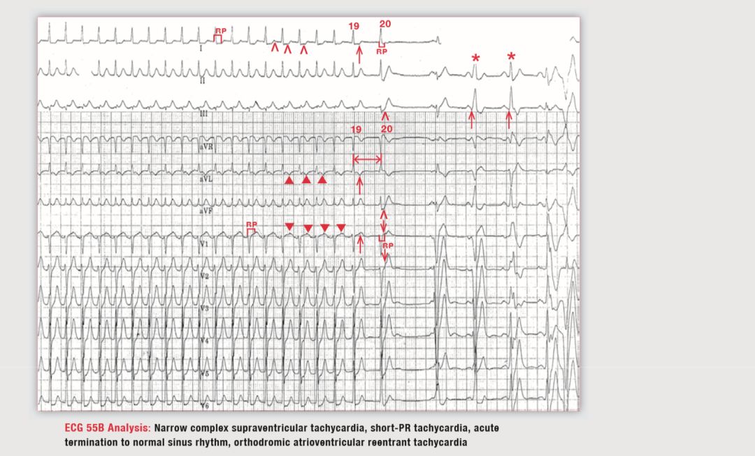 读心有术265,读心有术205期视频