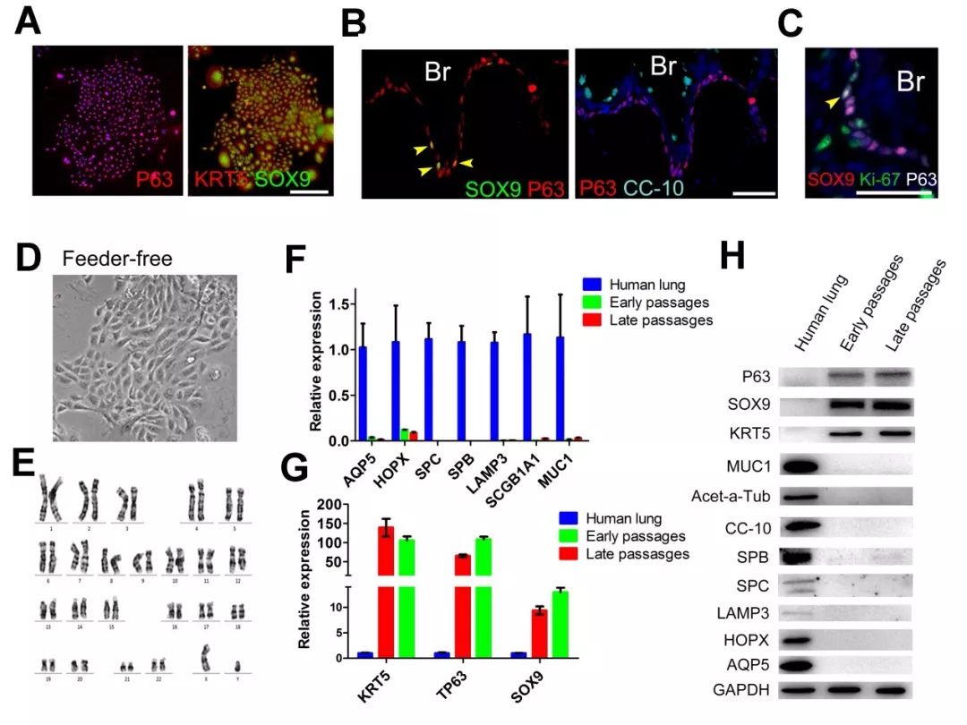 人类干细胞重造动物器官,人类首次肺脏再生是哪一年