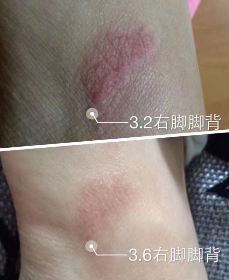 热卖|素颜拼过谢娜?你值得拥有Ta!