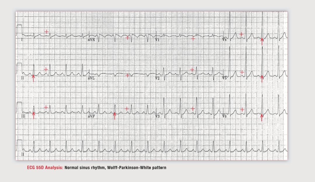 读心有术265,读心有术205期视频