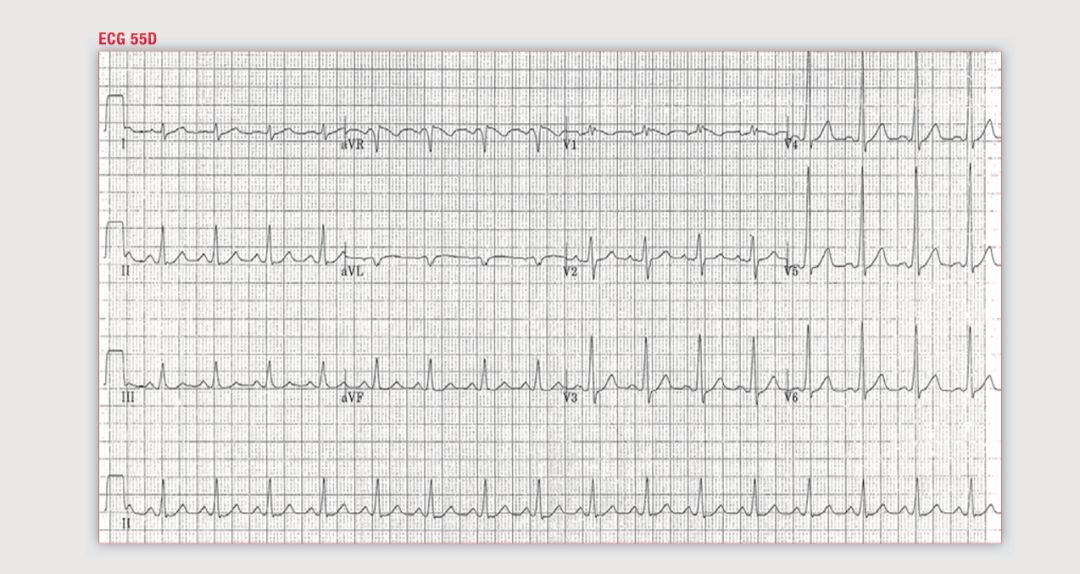 读心有术265,读心有术205期视频