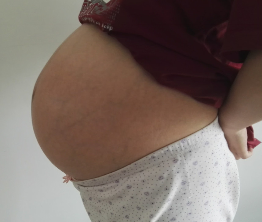 为什么女人顺产比剖腹产更容易,为什么现在顺产要侧切