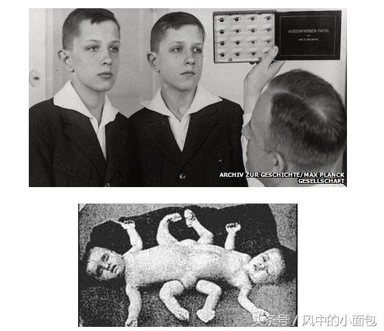 一半是科学,一半是冷血,历史上那些臭名昭著的科学实验