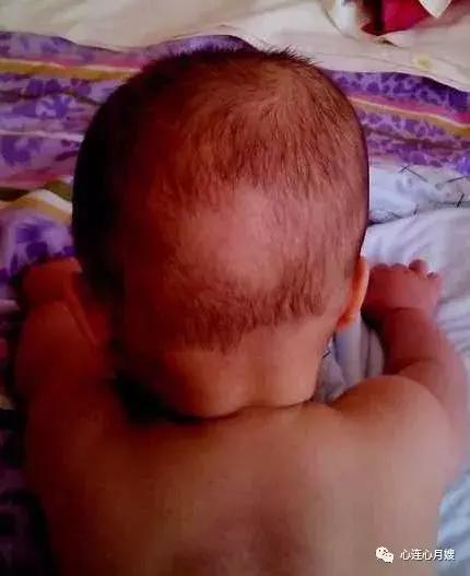 宝宝头睡偏了怎么补救,一岁宝宝头睡偏了怎么办