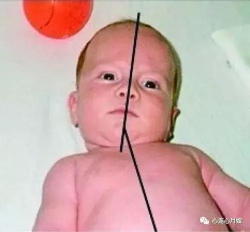 宝宝头睡偏了怎么补救,一岁宝宝头睡偏了怎么办