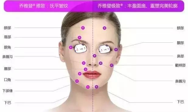 什么牌子玻尿酸平价又好用,樱花牌子的玻尿酸效果怎么样