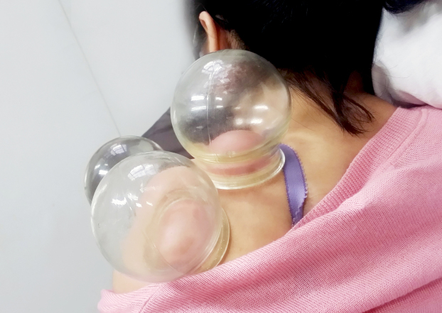 推拿系列之肩关节周围炎