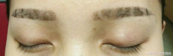 绣眉第二次补眉还掉痂吗,绣眉10天了眉毛痒