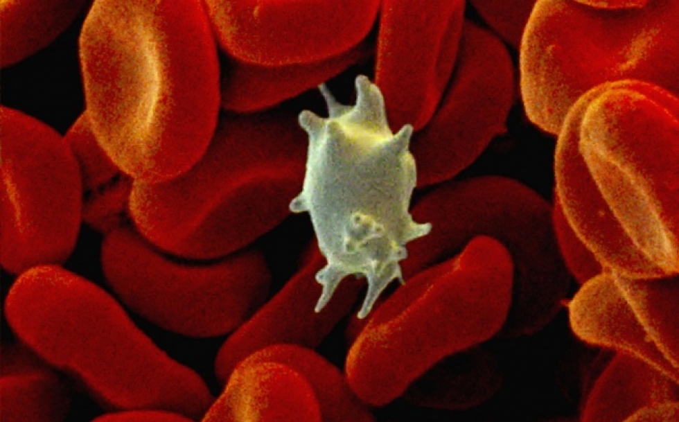 人为什么磕碰一下就淤青了,没磕没碰身上出现淤青民间说法