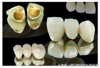 烤瓷牙表面掉瓷了对人身体有害吗,小加工厂做的烤瓷牙对身体有害吗