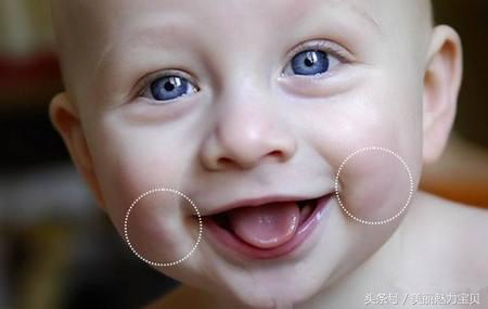 宝宝嘴角内侧有两个小肉疙瘩,宝宝嘴巴两侧有肉团