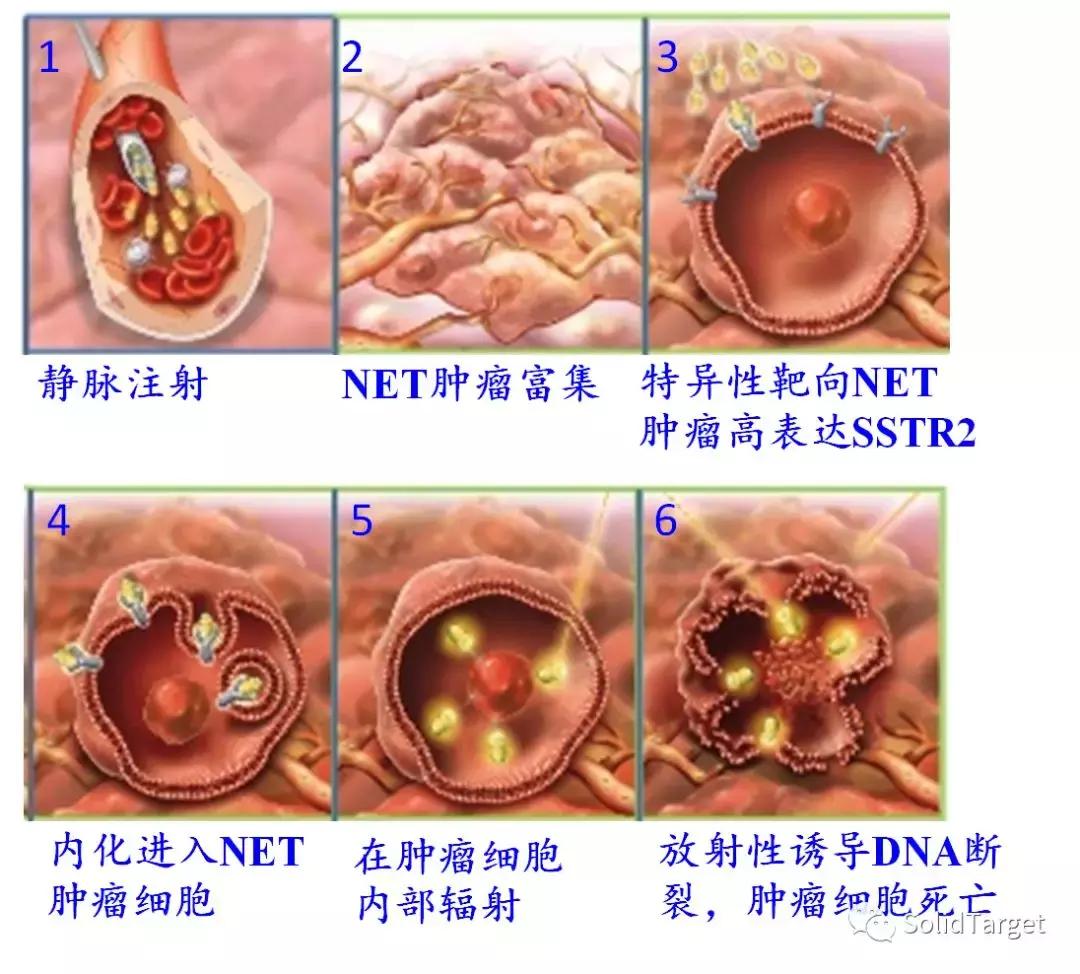 癌症治疗新策略靶向休眠细胞,21世纪肿瘤新疗法
