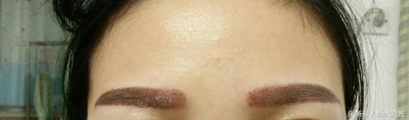 绣眉第二次补眉还掉痂吗,绣眉10天了眉毛痒