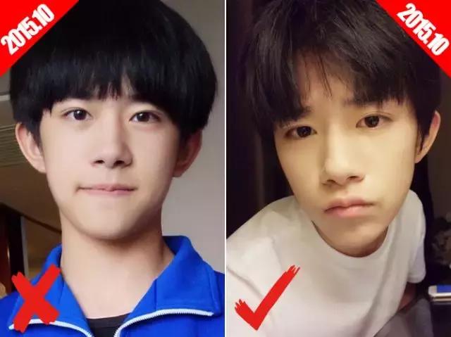 易烊千玺为什么颜值变化这么大,易烊千玺近年来的颜值变化