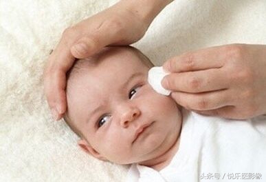 新生婴儿眼睛可以滴什么眼药水,新生儿宝宝可以滴眼药水吗