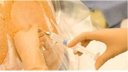 为什么现在生孩子要打催产素,遇到生孩子这个事应该怎么办