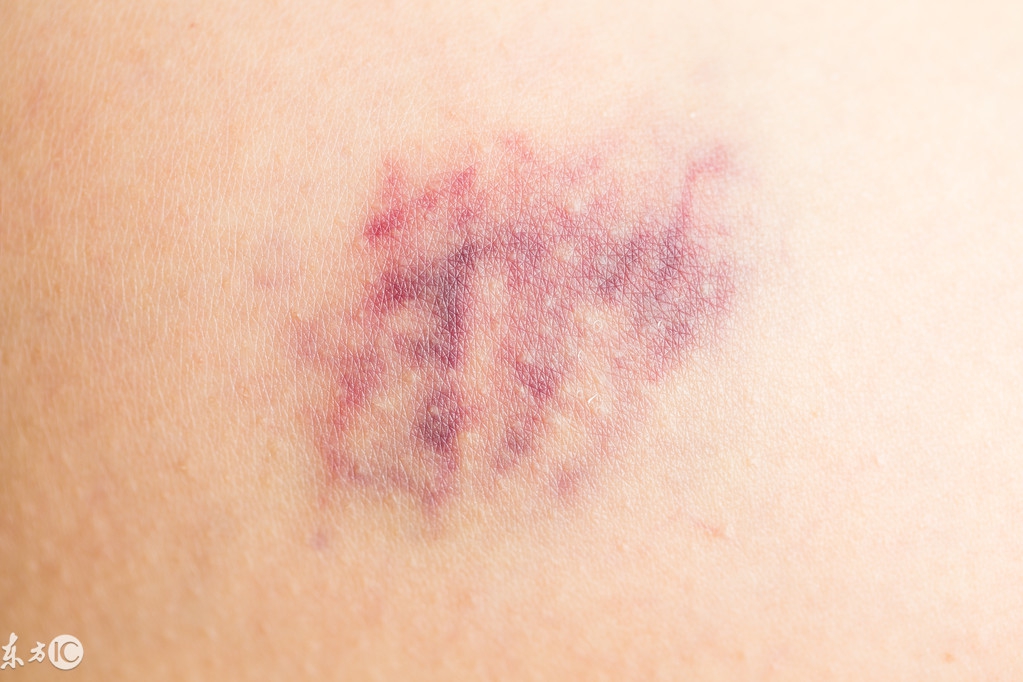 王奶奶在家不慎摔倒了,王奶奶穿高跟鞋摔跤