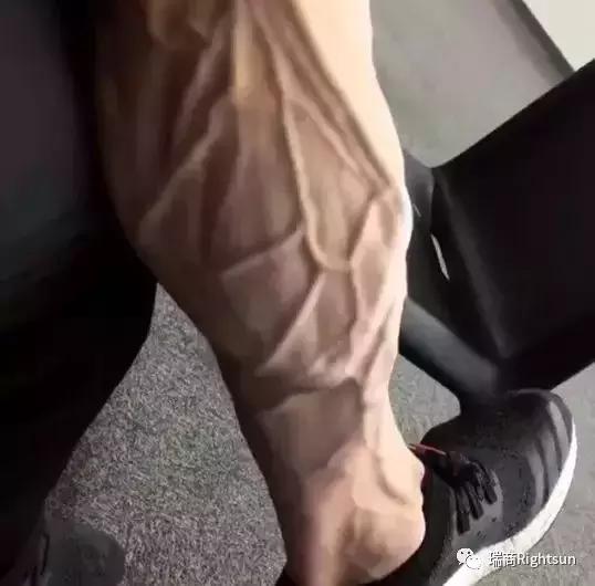 健美冠军体脂率是多少,26岁健美冠军小腿静脉爆裂