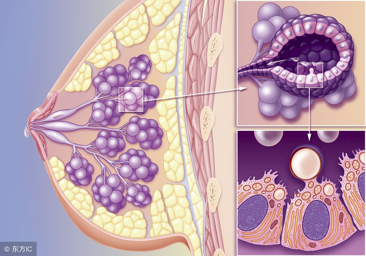 乳腺增生会癌变吗,男性乳腺增生会癌变吗