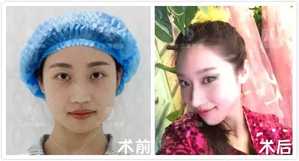 热巴赵丽颖合照,热巴与赵丽颖同框