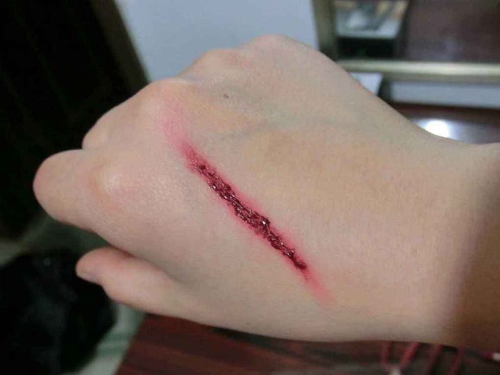 李斯特菌和真菌的区别,李斯特菌是什么