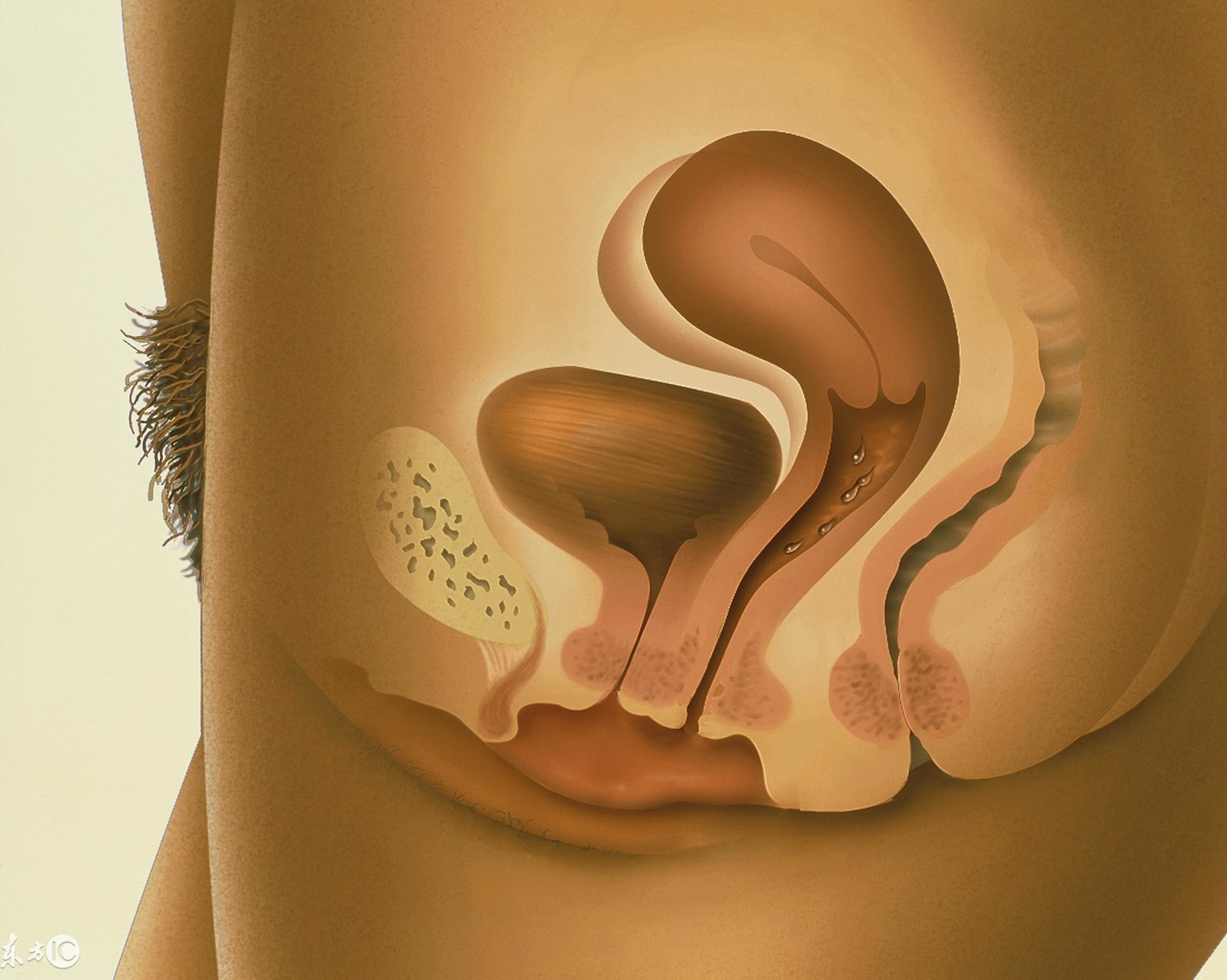 女人得了什么病需要切子宫,女人得什么病需要切子宫