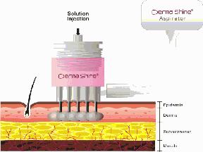 肌肤松弛显毛孔粗大用什么产品,老化型毛孔粗大如何改善小技巧