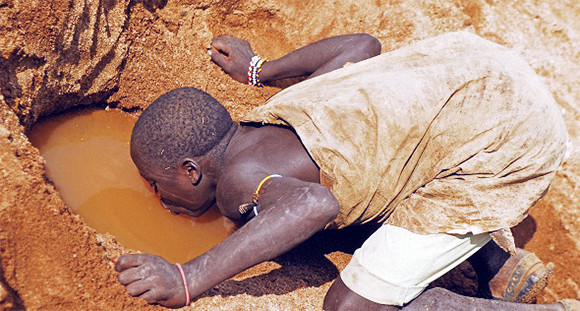 实拍:那些饱受摧残的非洲儿童,穷得让人无法想象!