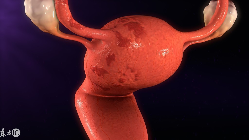 病理报告子宫内膜增生伴不典型,病理诊断子宫内膜呈增生期反应