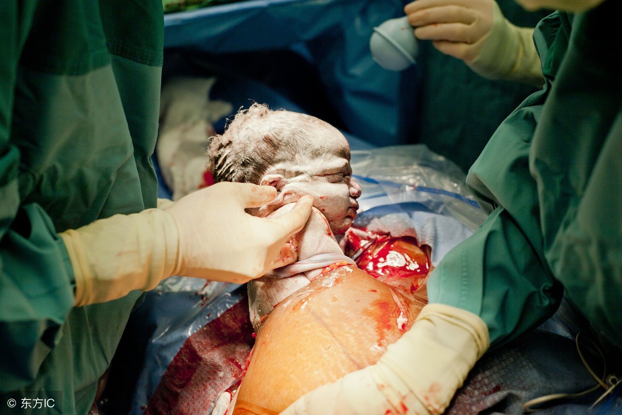 剖腹产最疼6个时刻,剖腹产坐月子好难熬啊