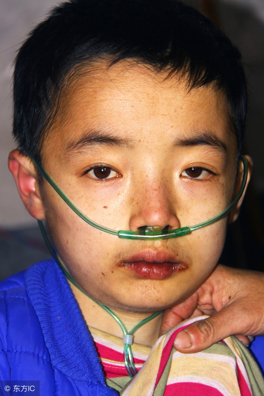 心力衰竭的病人为什么要低盐饮食,心力衰竭的患者饮食注意事项