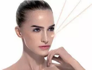 光子嫩肤真实效果图,光子嫩肤一次多少钱