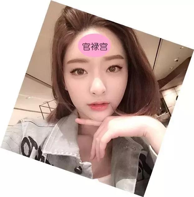 AnnaG教你整|丰额头,能增加运气吗?