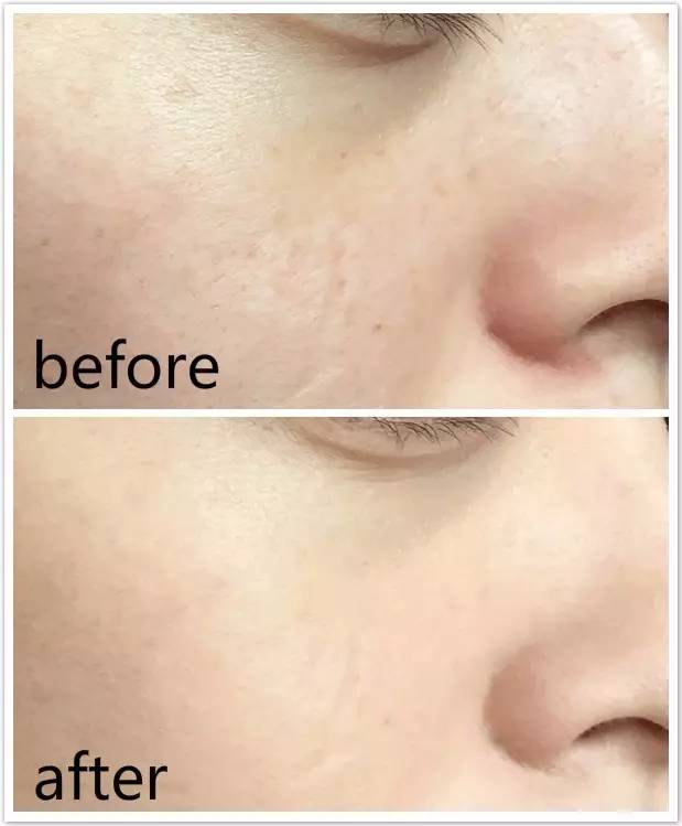 气垫bb怎么用更服帖,气垫bb买什么最好