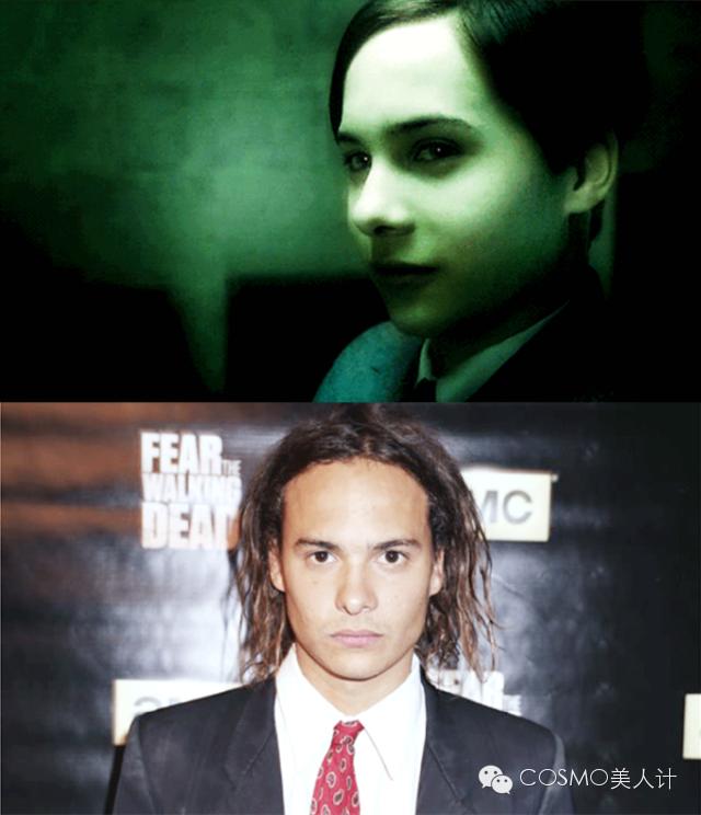 断发脱发怎么救,断头发该怎么护理