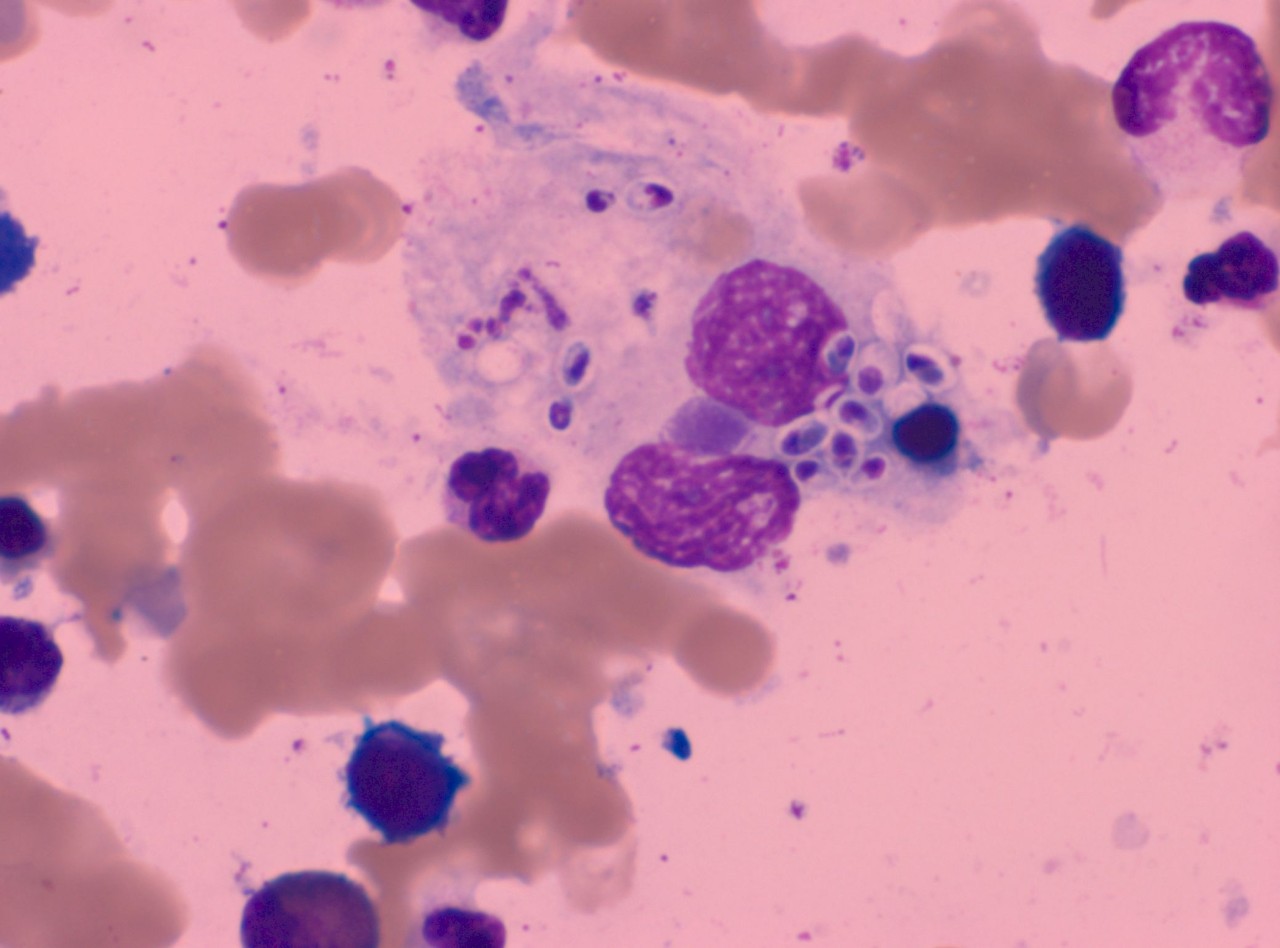 胞浆内颗粒减少,胞浆内颗粒增多