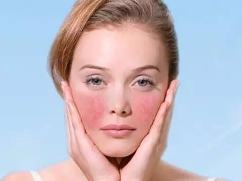 日本敏感肌面霜推荐,日本敏感肌护肤品