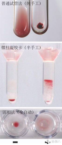 是COOMBS，不是Combs|一页手册·协和八