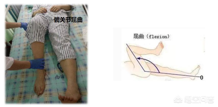 膝关节康复及保护的科普,膝关节康复训练科普