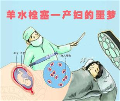 临床医生是怎样进行羊水栓塞诊断