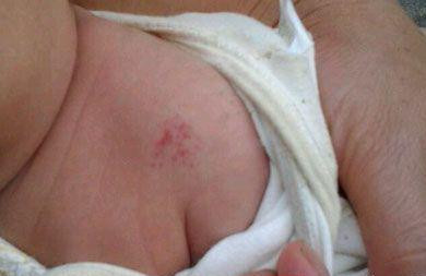 身体一处发黑暗示了2种癌症,身体有部位发黄怎回事