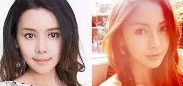 重庆女孩自曝整容日记，迷教主花百万变形为Angelababy