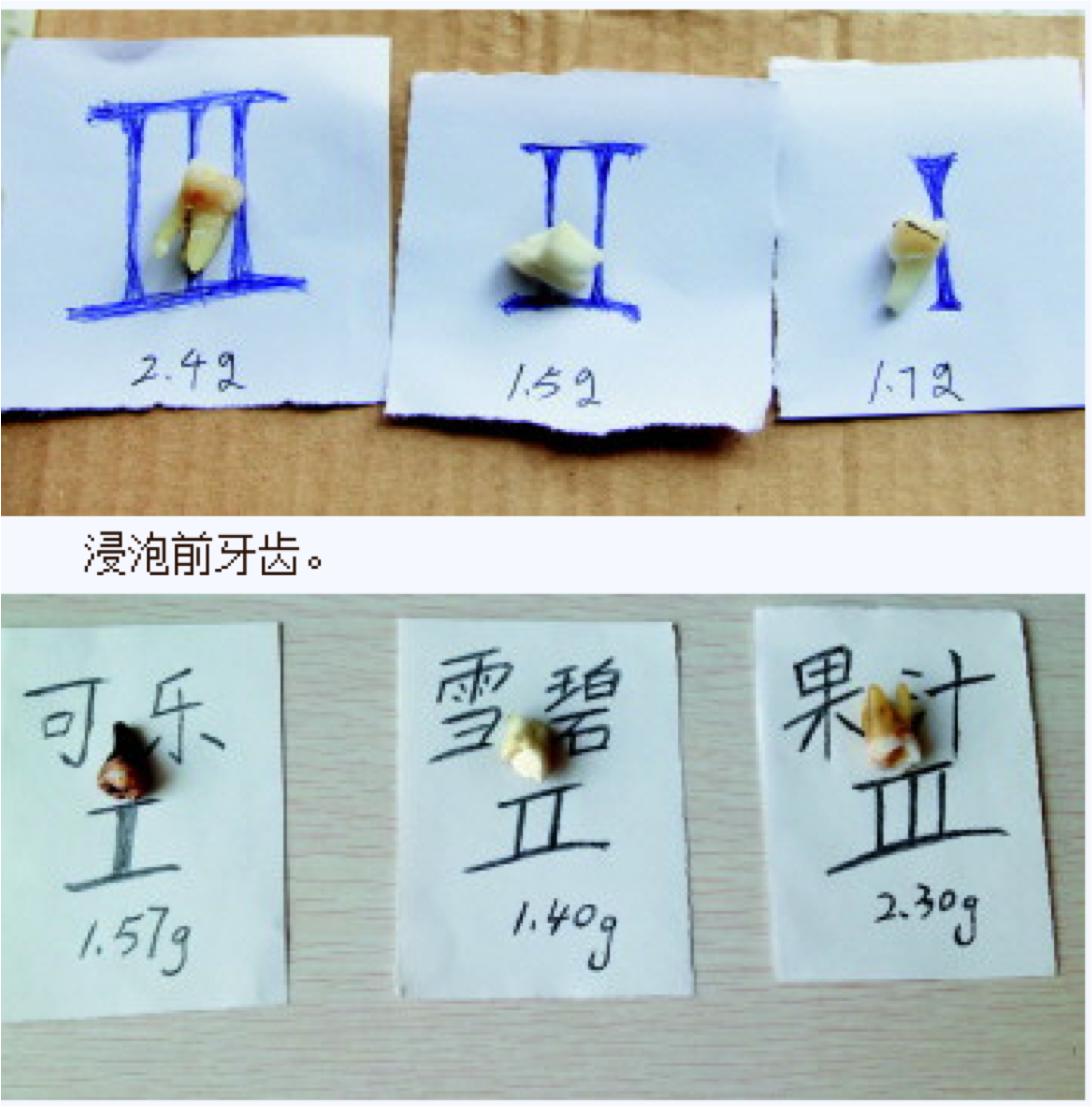 10岁小孩蛀牙怎么处理,10岁牙齿蛀牙烂掉怎么办