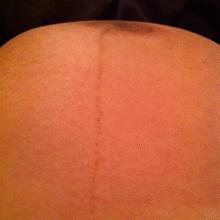 麻烦查一下什么叫胎动,肉眼可以看到胎动嘛